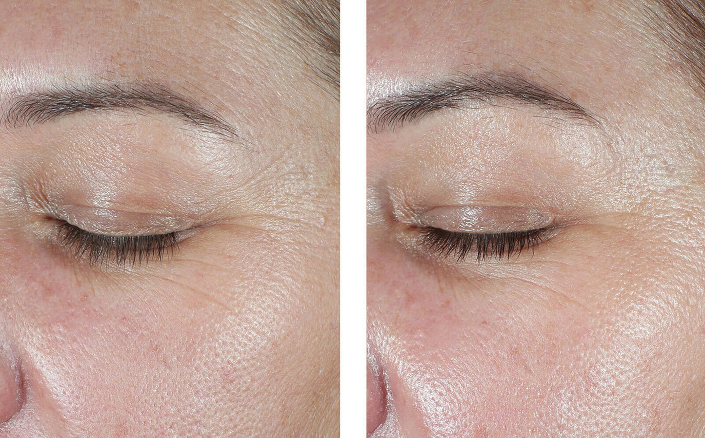 EyeMax AlphaRet Overnight Cream