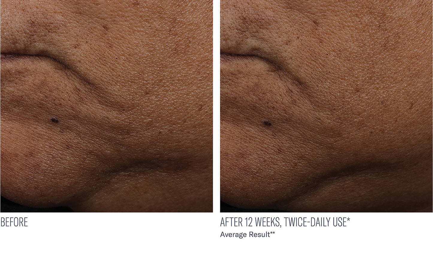 InterFuse Treatment Cream FACE & NECK