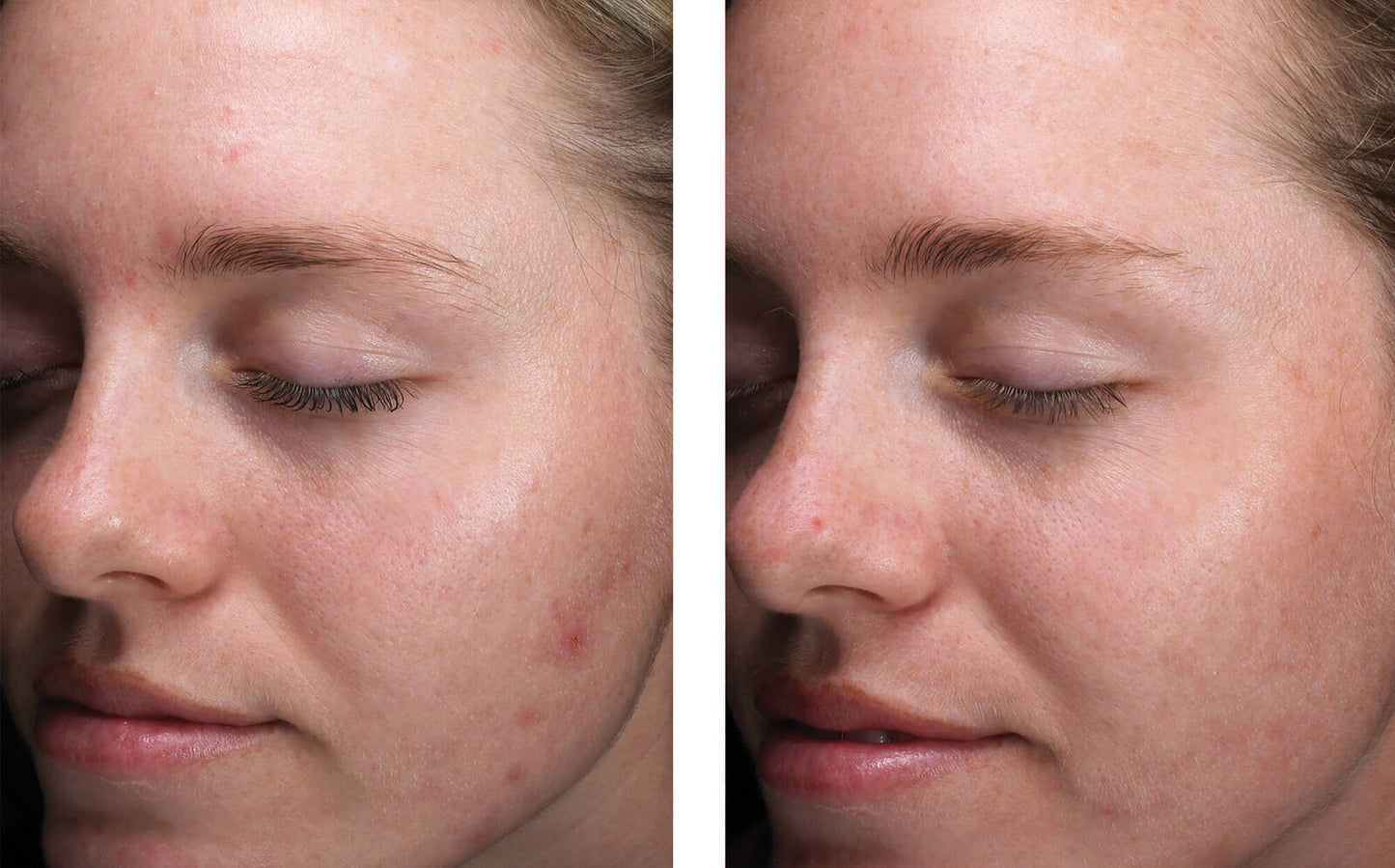 AlphaRet Clearing Serum