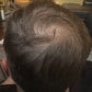 Hair Growth Gummies