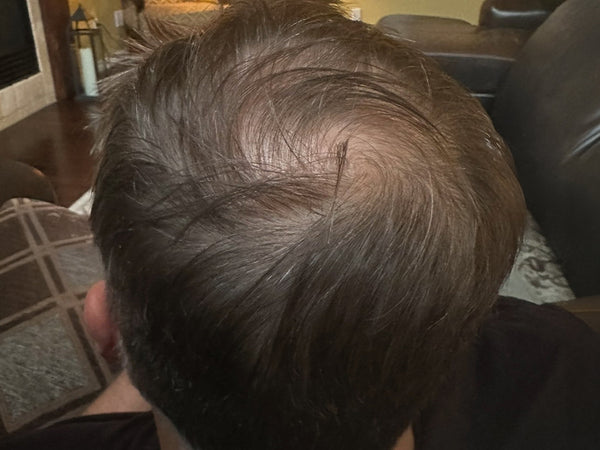 Hair Growth Gummies