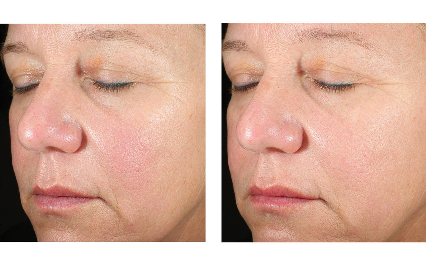 Alto Advanced Defense and Repair Serum