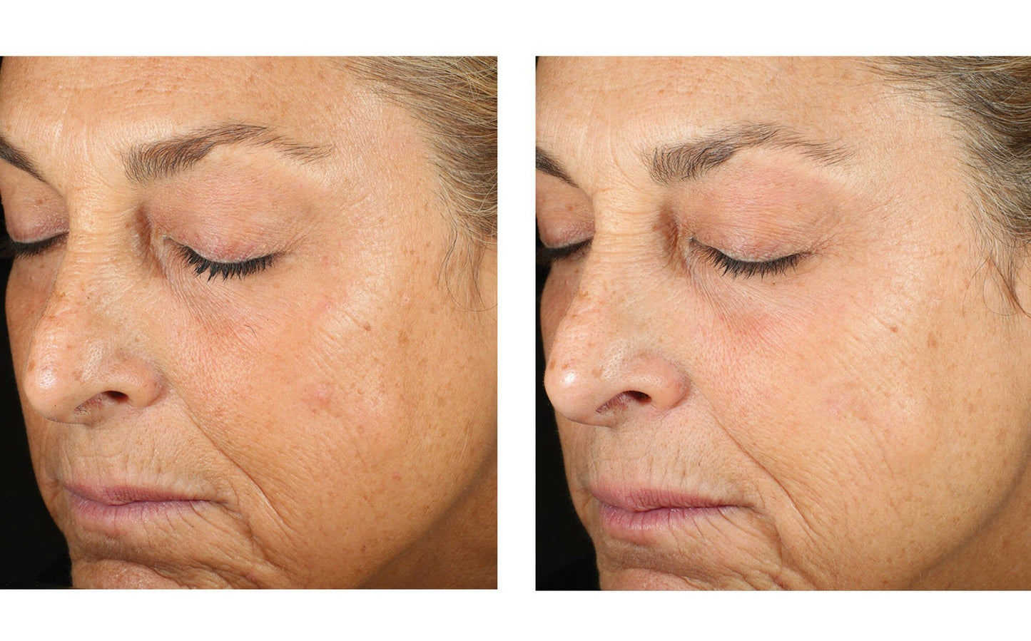 Alto Advanced Defense and Repair Serum