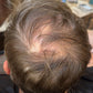 Hair Growth Gummies