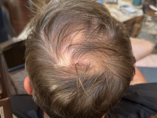 Hair Growth Gummies