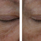 InterFuse Treatment Cream EYE