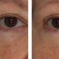 InterFuse Treatment Cream EYE