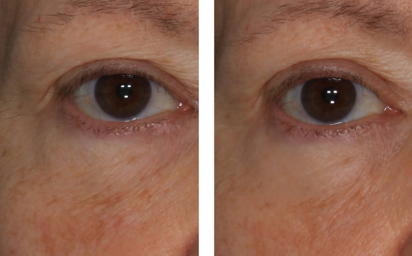 InterFuse Treatment Cream EYE