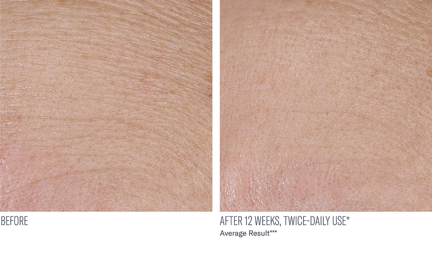 InterFuse Treatment Cream FACE & NECK