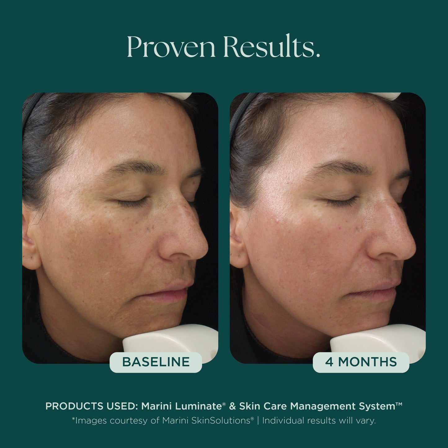 Luminate® Face Lotion