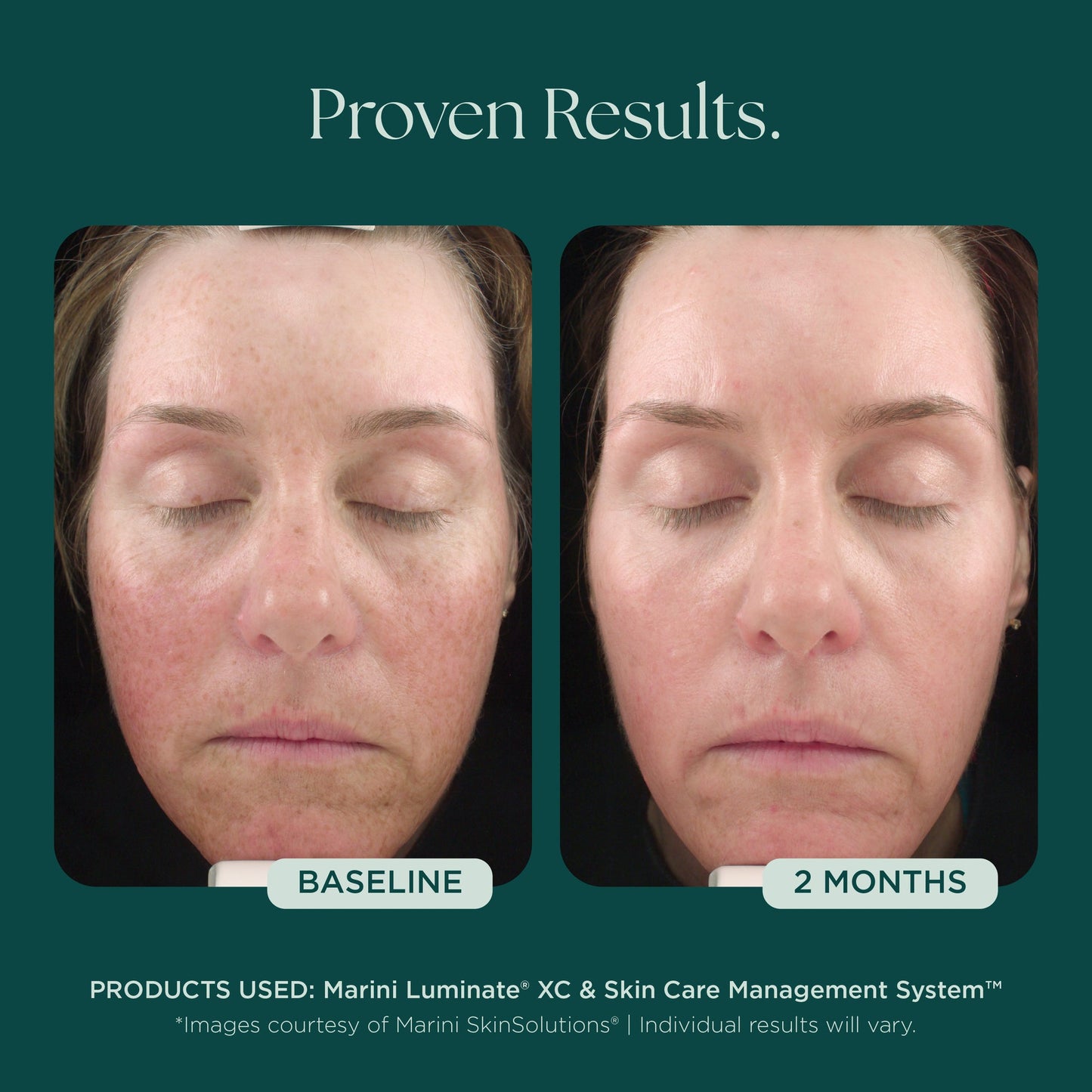 Luminate® XC Face Lotion