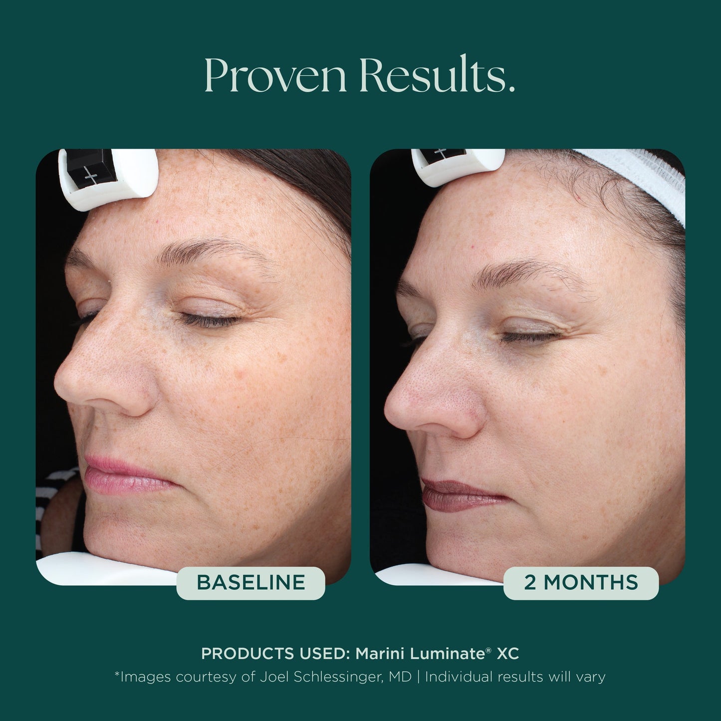 Luminate® Face Lotion