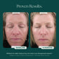 Retinol Plus XC