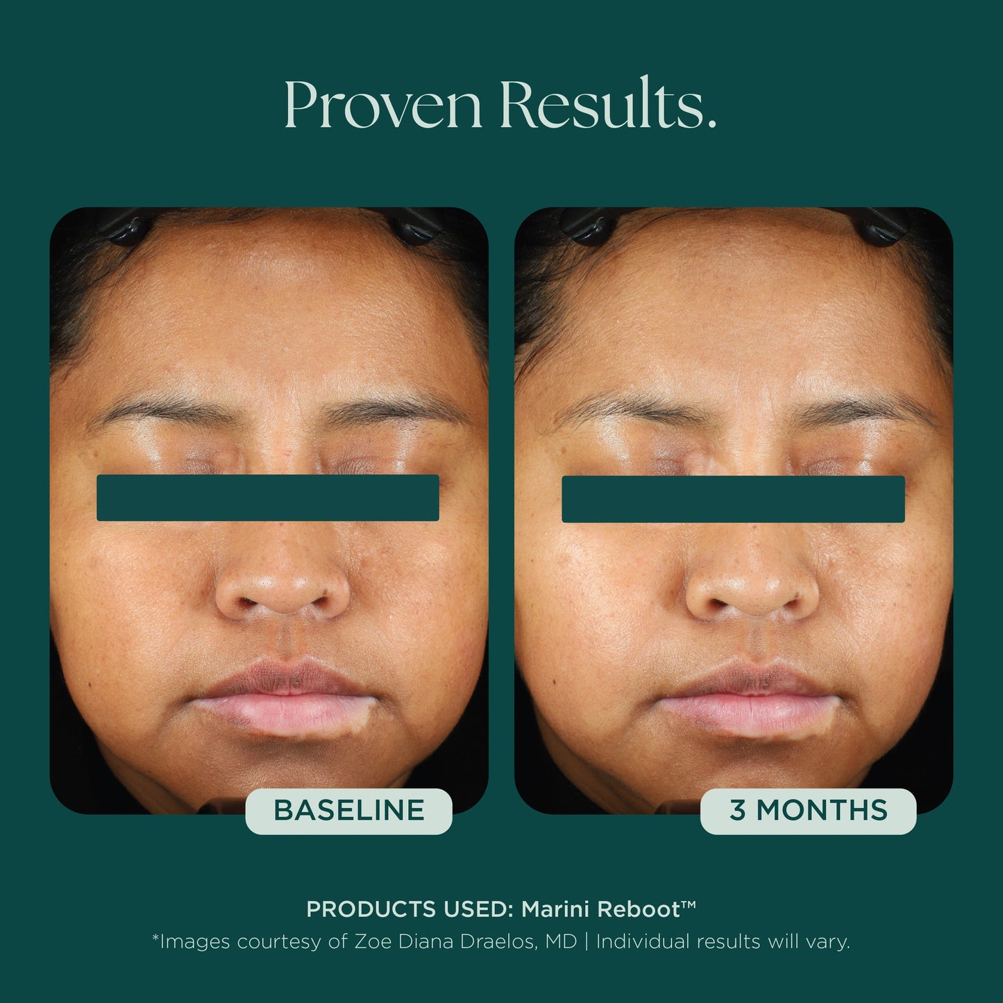 Reboot® PDRN Face Serum