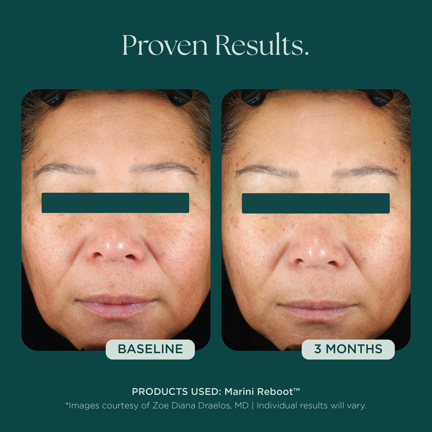 Reboot® PDRN Face Serum