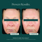 Reboot® PDRN Face Serum