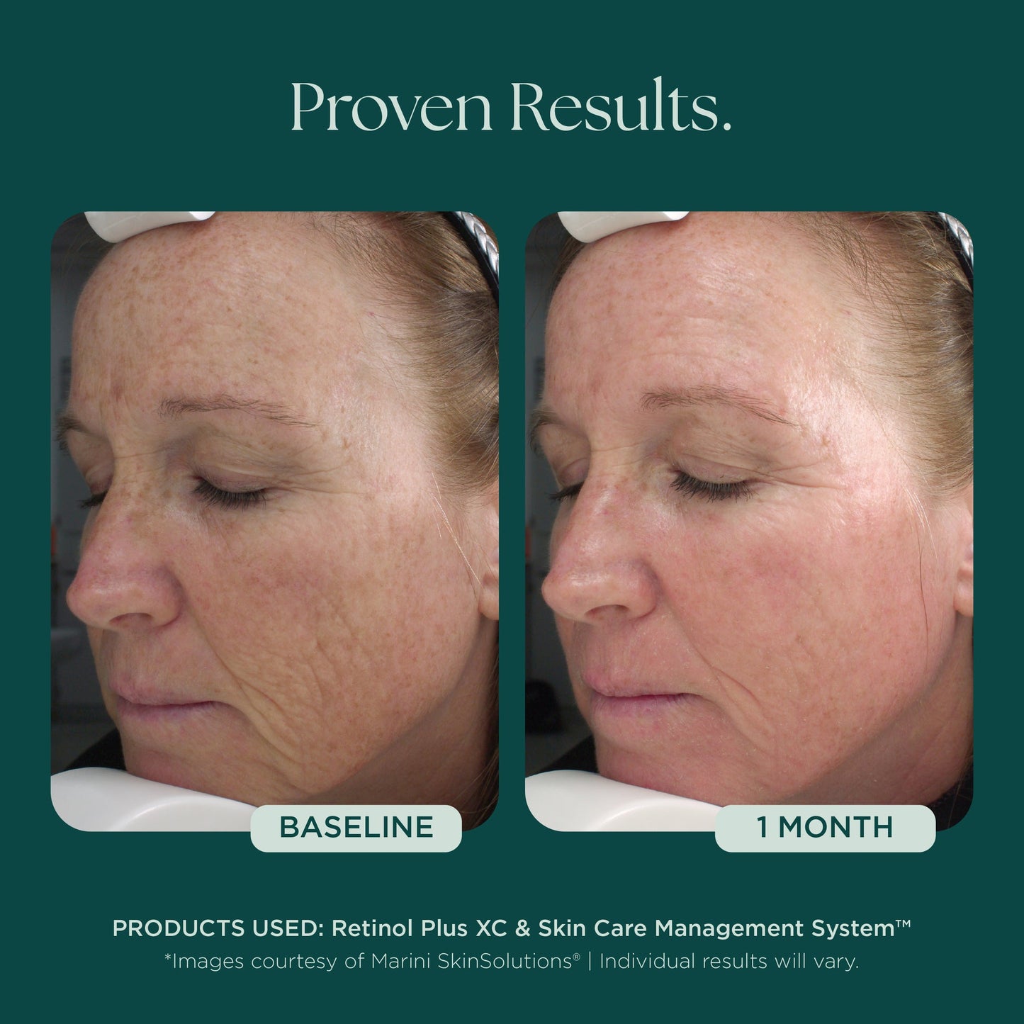 Retinol Plus