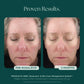 RosaLieve® Redness Reducing Complex