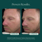 RosaLieve® Redness Reducing Complex