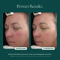 RosaLieve® Redness Reducing Complex