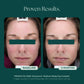 RosaLieve® Redness Reducing Complex