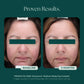 RosaLieve® Redness Reducing Complex