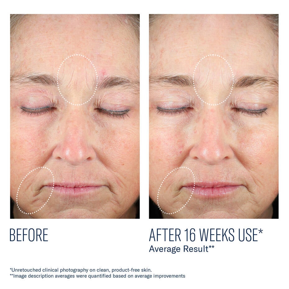 Mystro Revive Renewing Serum