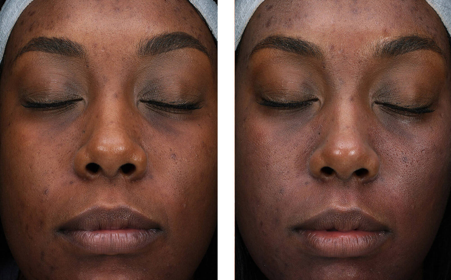 sunbetter SHEER SPF 56 Mineral Sunscreen Compact