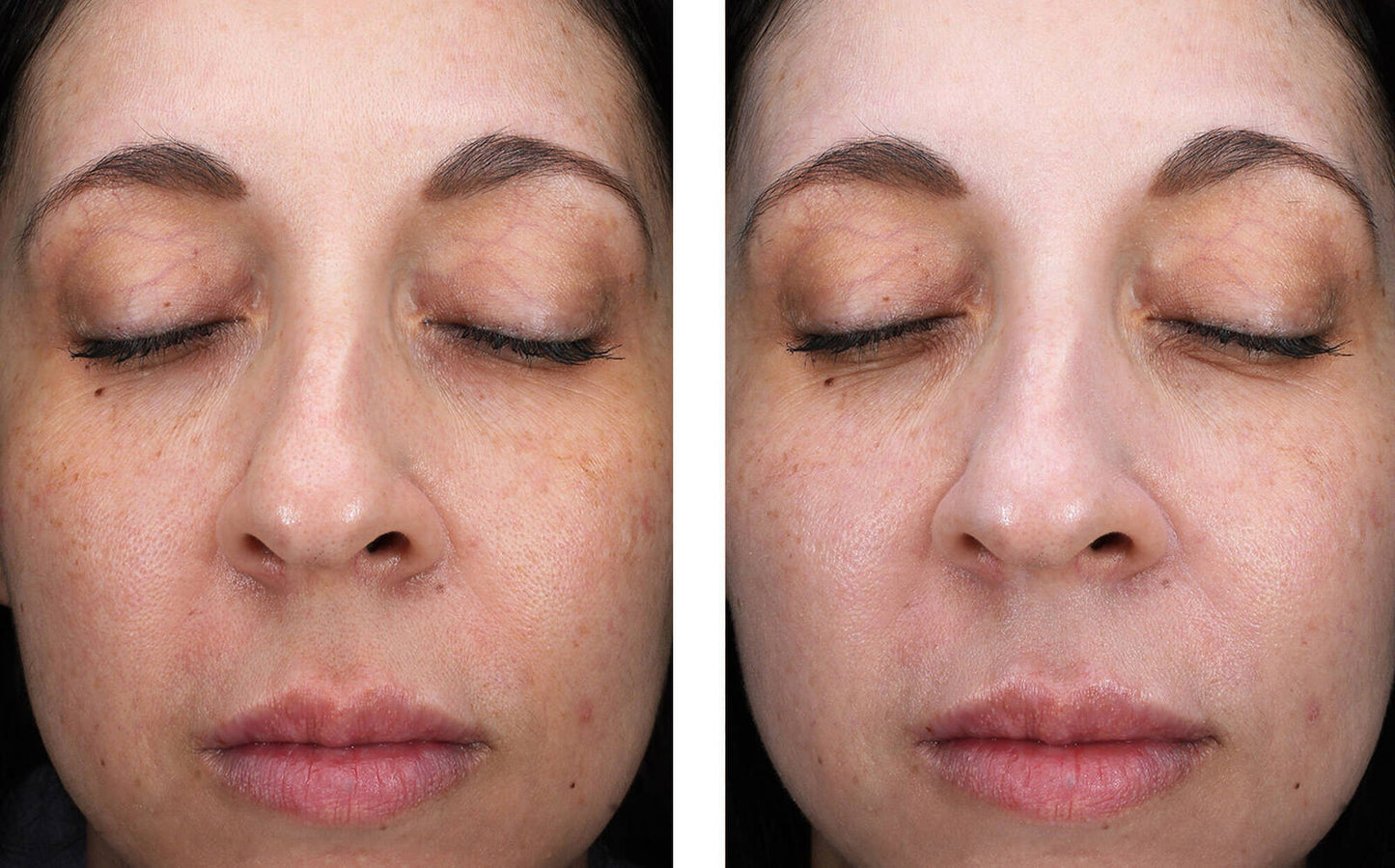 sunbetter SHEER SPF 70 Sunscreen Lotion