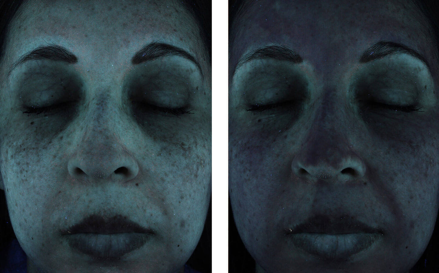 sunbetter SHEER SPF 70 Sunscreen Lotion