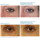 Total Eye® Serum & Hydrogel Masks