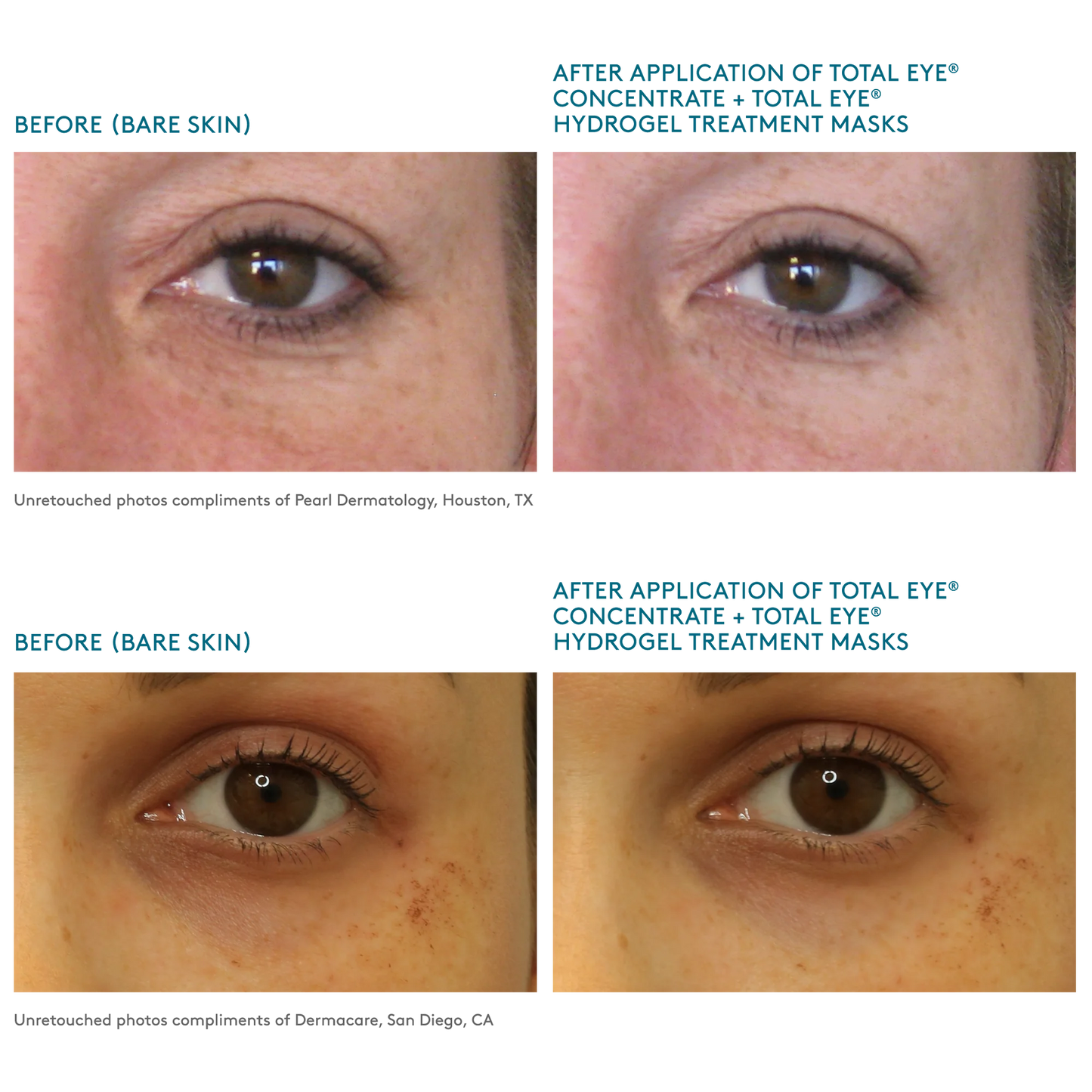 Total Eye® Serum & Hydrogel Masks