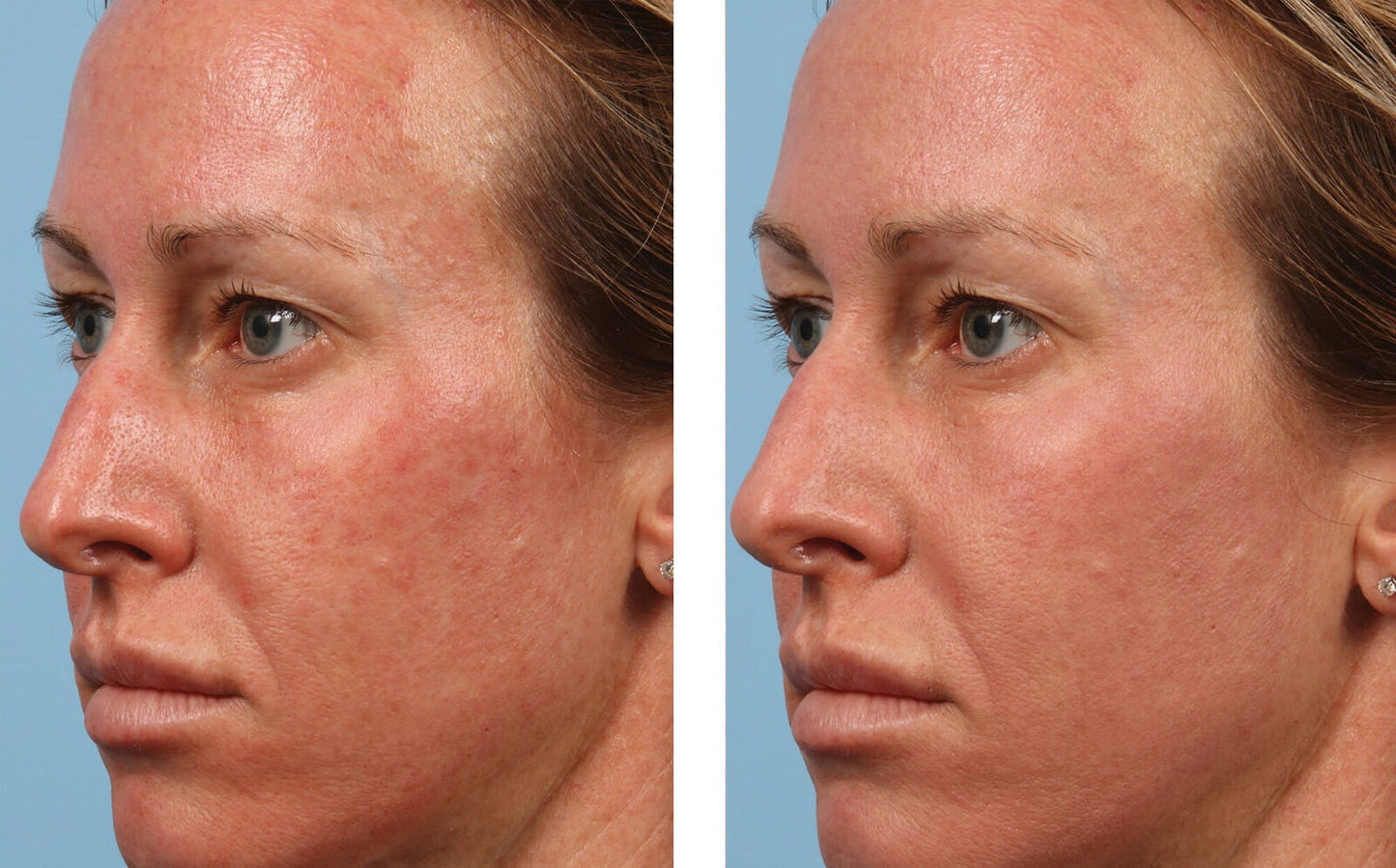 sunbetter TONE SMART SPF 68 Sunscreen Compact