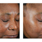 Trio Luxe Moisture Treatment