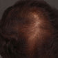 Hair Growth Gummies