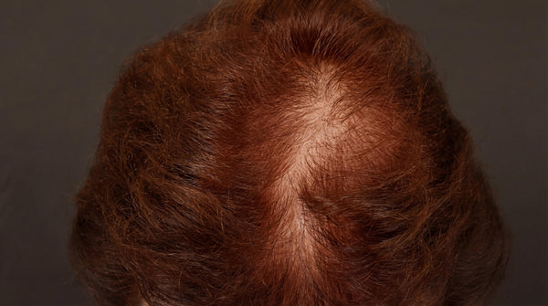 Hair Growth Gummies