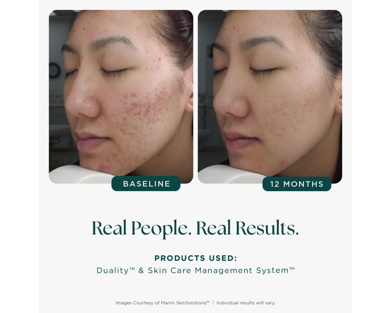 Age Intervention® Duality™